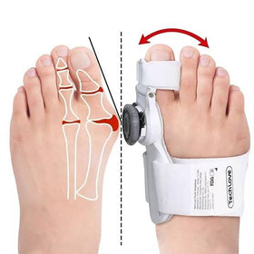 Feet Care Toe Bunion Splint Corrector Orthopedic Braces