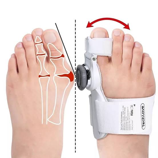 Feet Care Toe Bunion Splint Corrector Orthopedic Braces
