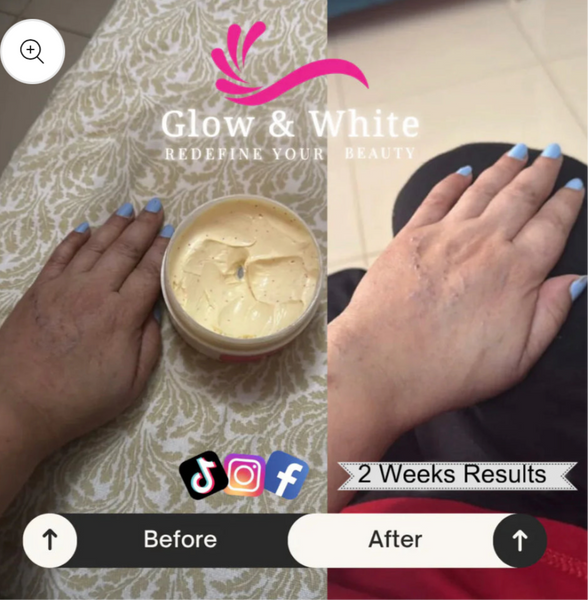 Zafrani whitening cream