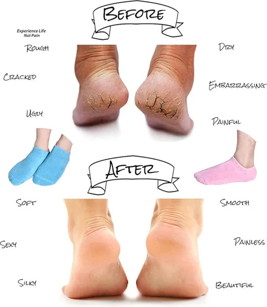 Inner silicon Moisturizing Socks